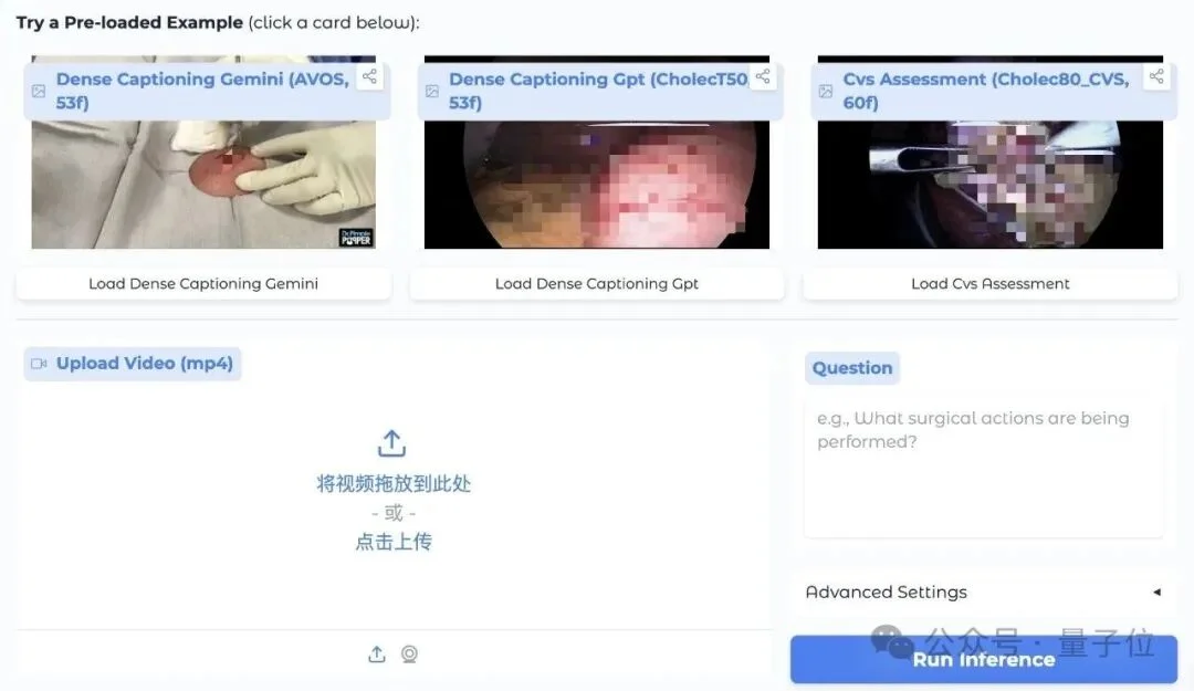 全球首个医疗视频理解大模型uAI Nexus MedVLM开源！6k+精标测试集与英雄榜同步上线，开发者速来体验