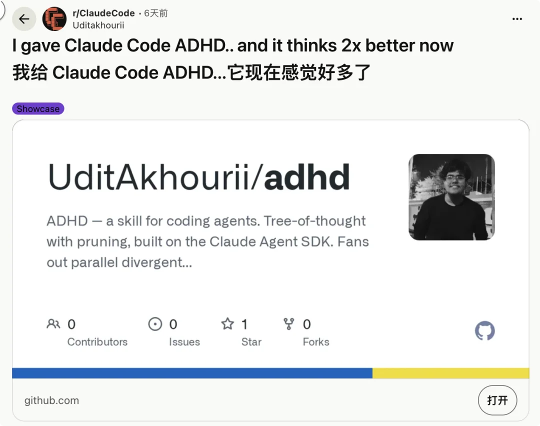 如何让你的 Claude Code，像 ADHD 那样思考